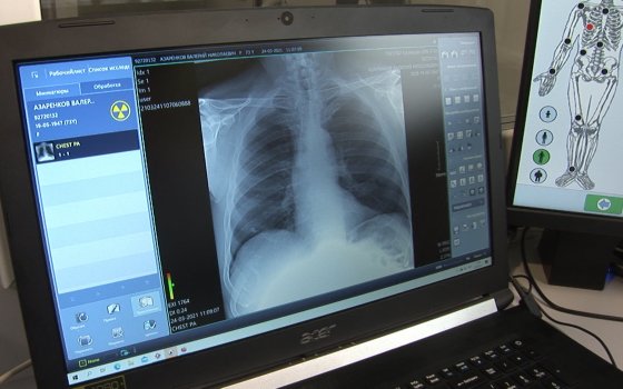 Всемирный день борьбы с туберкулёзом: как работают передвижные рентген-кабинеты